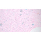 Tissue Control Slide, Iron